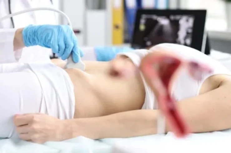 Whole Abdomen & Pelvic Scans-----11